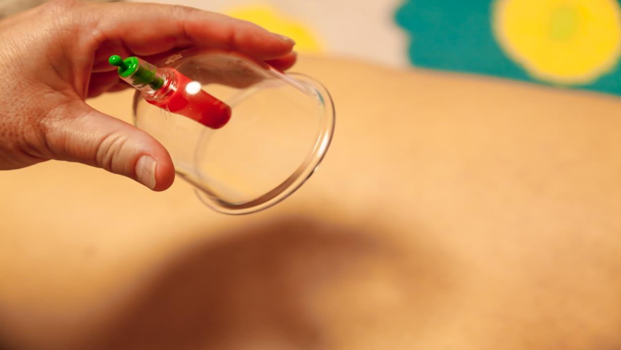 Insta Cupping - جلسات حجامة احترافية